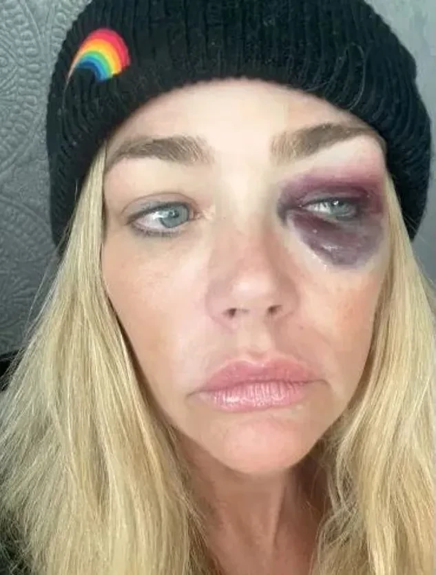 "Душил меня и угрожал убить". Дениз Ричардс обвинила мужа в домашнем насилии